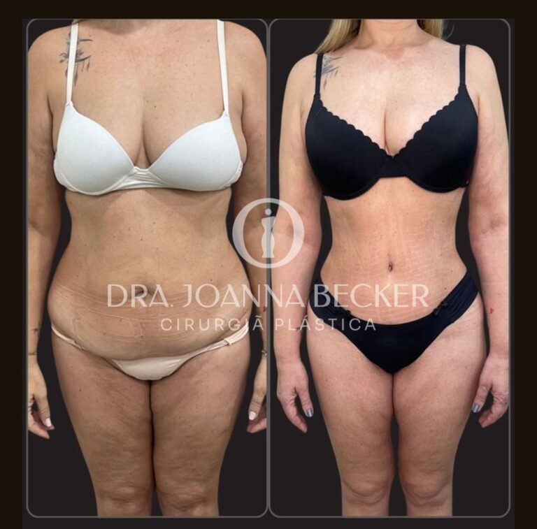 CapaFotos Antes e depois_2