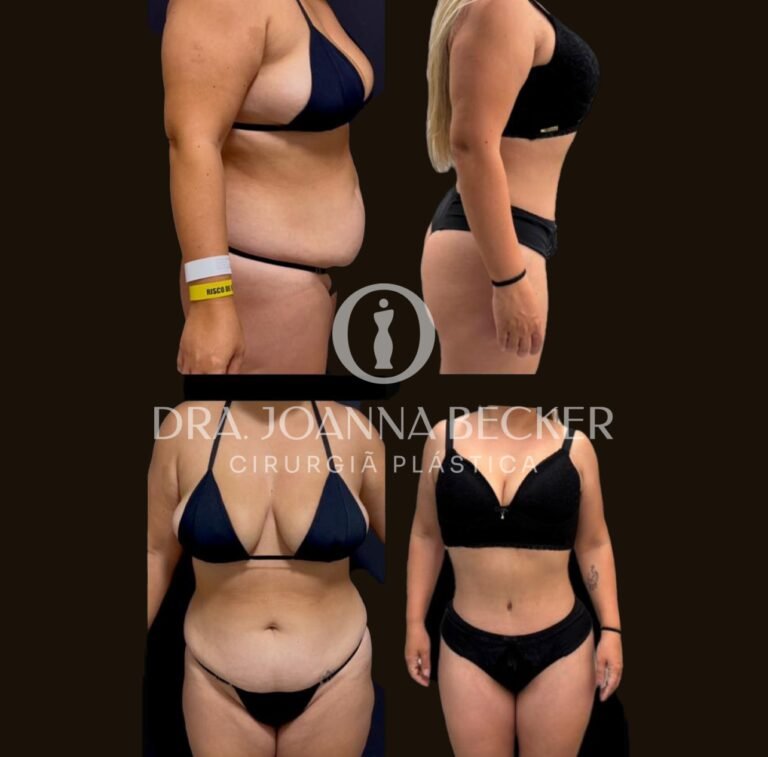 CapaFotos Antes e depois_3